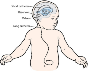 fig2-vp